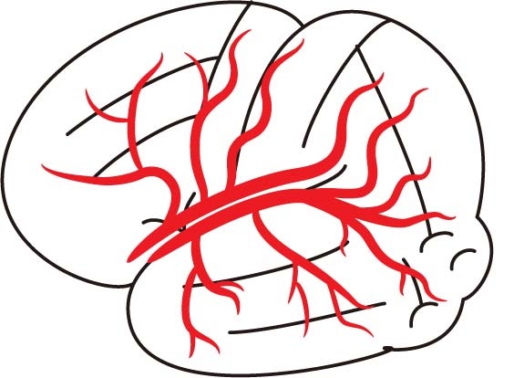 脳底動脈終末部(basilar top) 